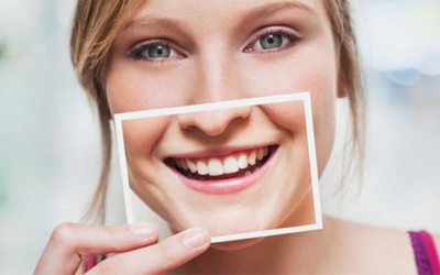 CLAREAMENTO DENTAL: Dente branco = Aparência mais jovem
